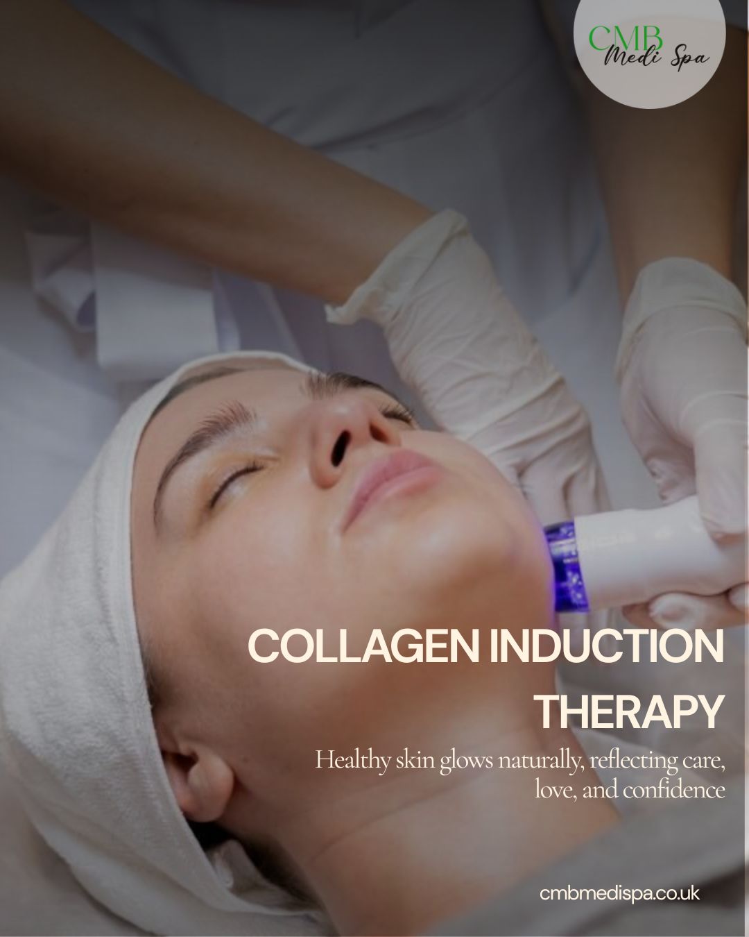 Collagen Induction Therapy Plymouth