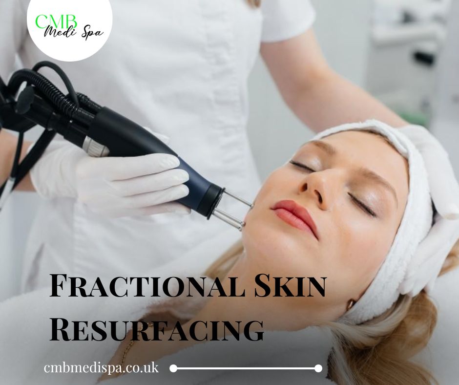 Fractional Skin Resurfacing Plymouth