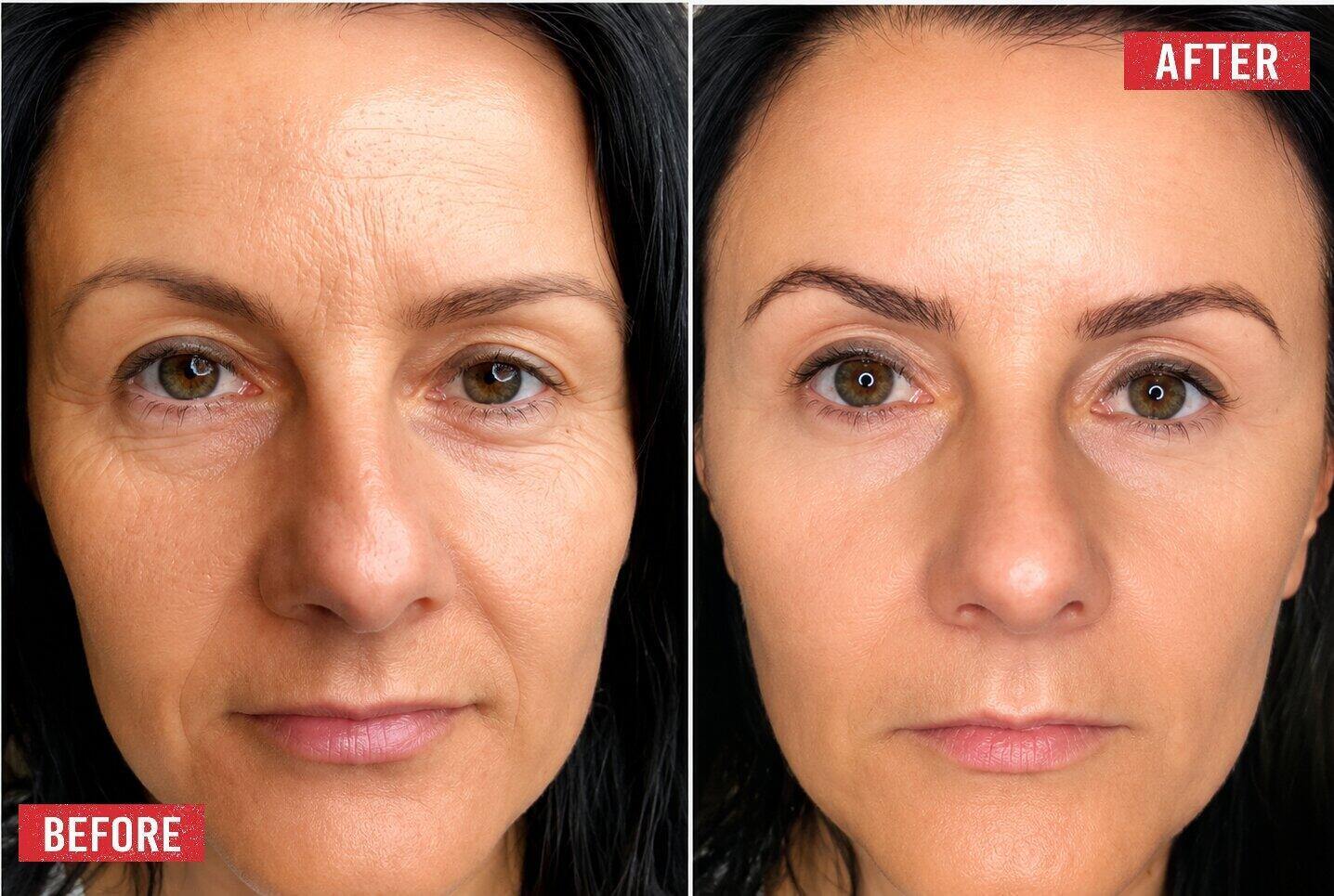 anti-ageing treatments