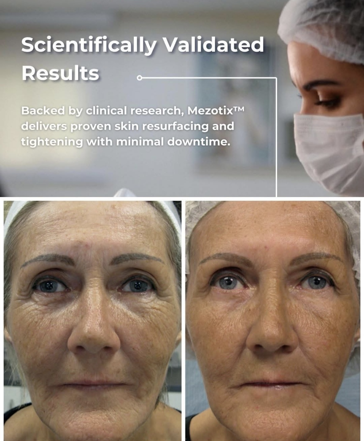 anti-ageing treatments